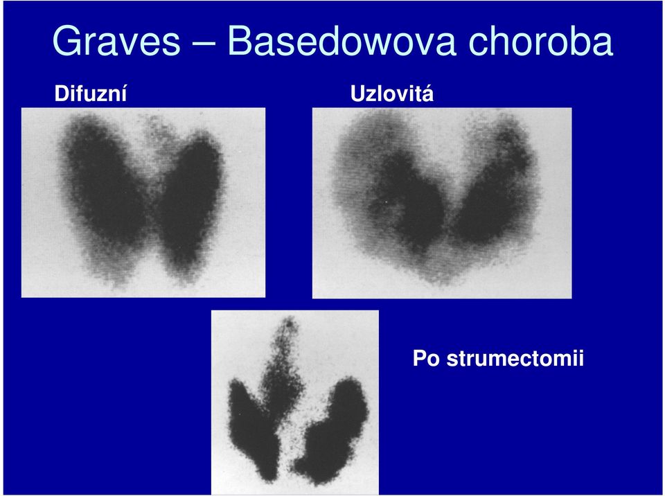 choroba