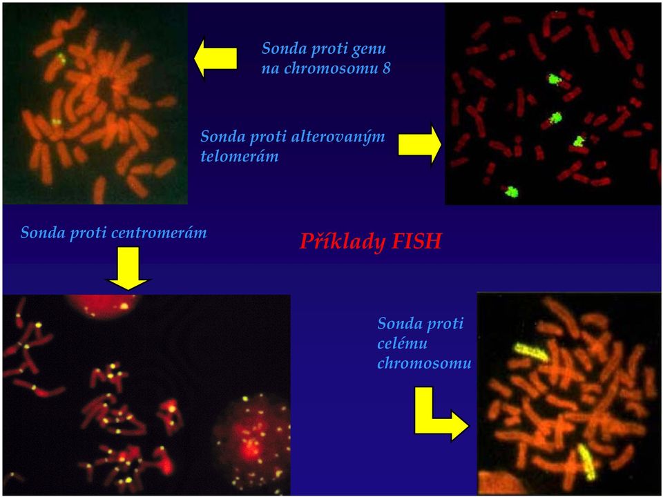 Sonda proti centromerám Příklady