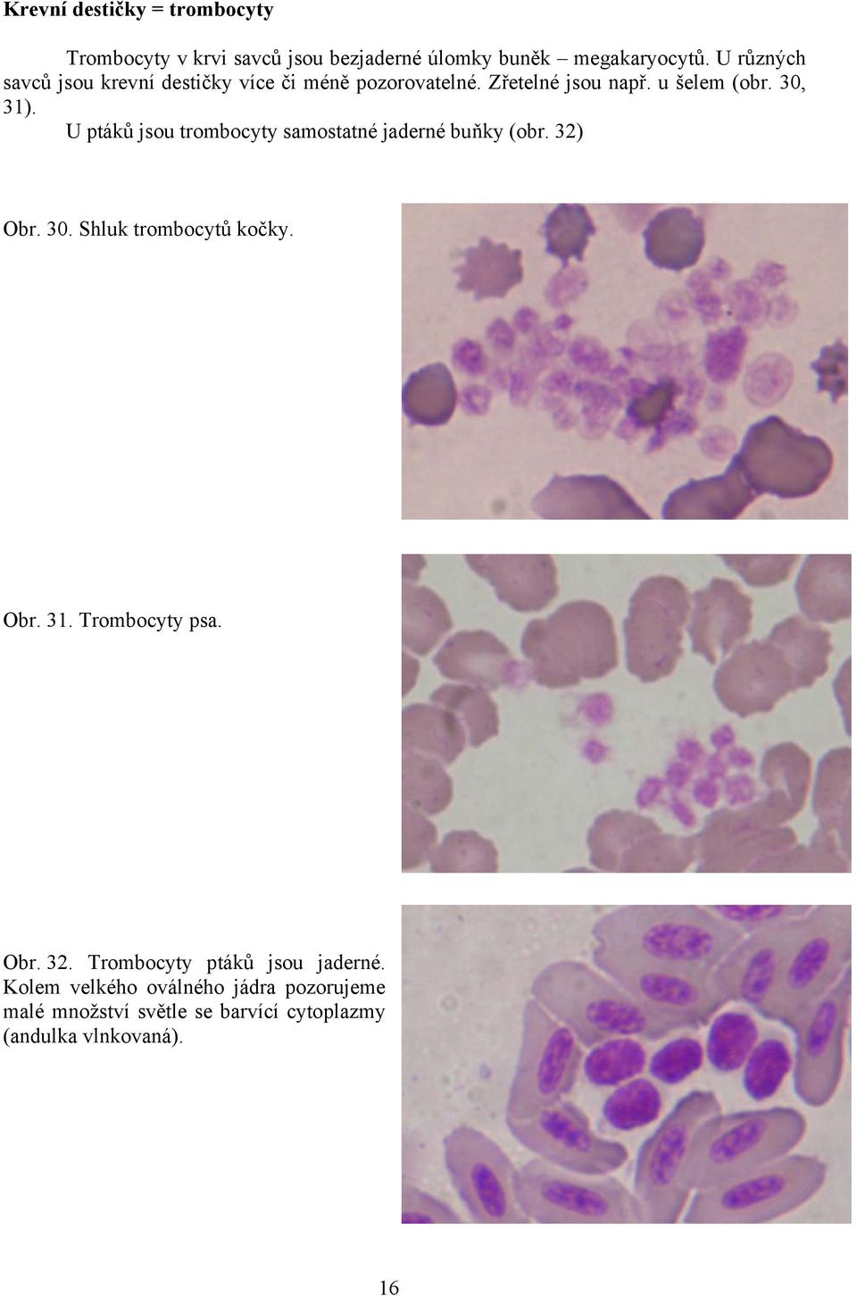 U ptáků jsou trombocyty samostatné jaderné buňky (obr. 32) Obr. 30. Shluk trombocytů kočky. Obr. 31. Trombocyty psa.