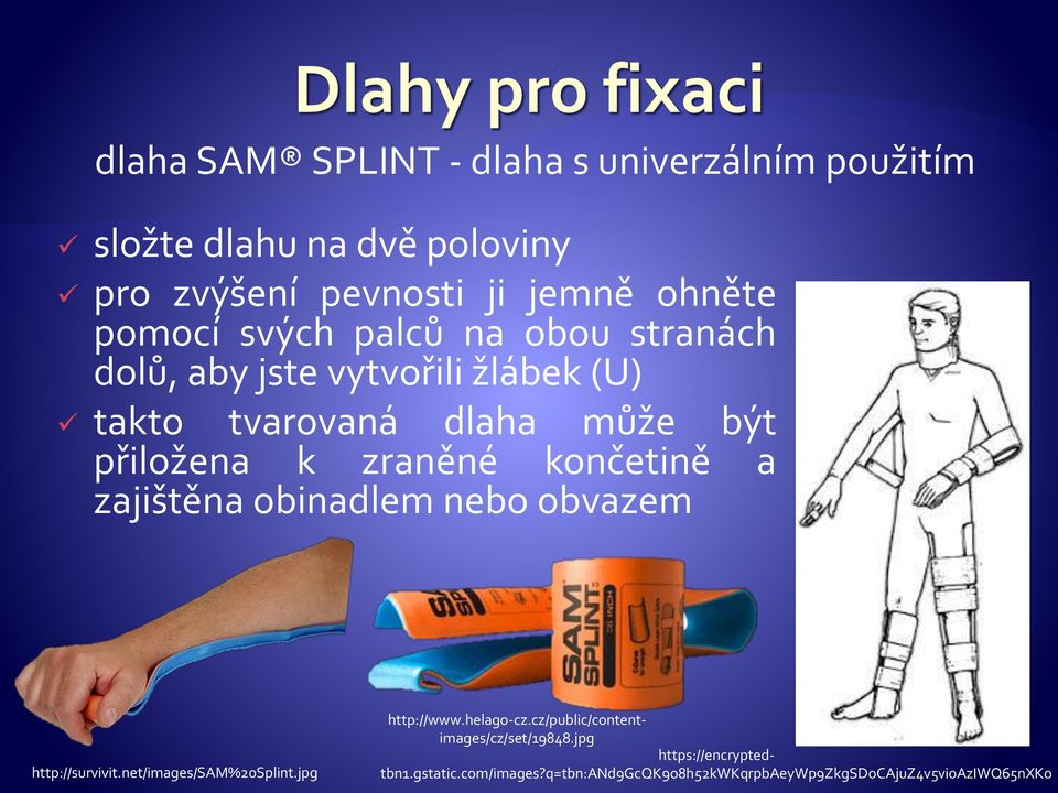 končetině a zajištěna obinadlem nebo obvazem http://survivit.net/images/sam%20splint.jpg http://www.helago-cz.