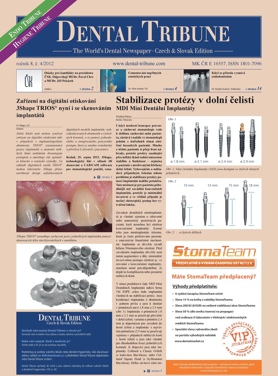 Irfan Ahmad, UK strana 4 Dr. Bojidar Kafelov, Bulharsko strana 14 Stabilizace protézy v dolní čelisti MDI Mini Dentální Implantáty Winfried Walzer Berlín, Německo Obr.
