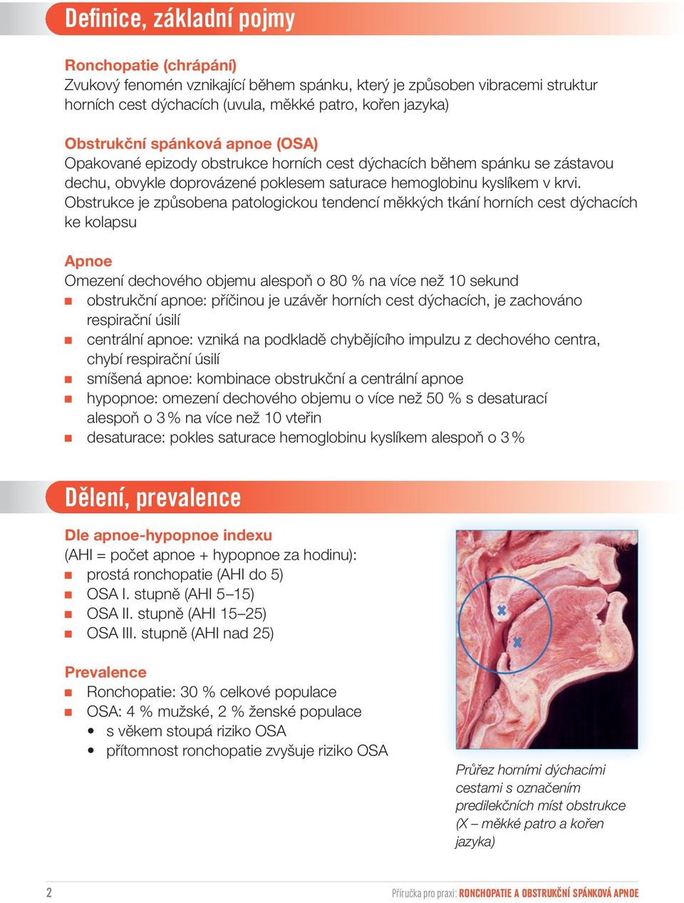 Obstrukce je způsobena patologickou tendencí měkkých tkání horních cest dýchacích ke kolapsu Apnoe Omezení dechového objemu alespoň o 80 % na více než 10 sekund obstrukční apnoe: příčinou je uzávěr