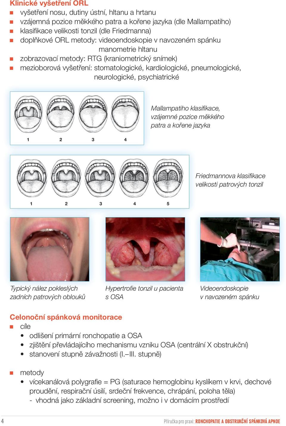 psychiatrické Mallampatiho klasifikace, vzájemné pozice měkkého patra a kořene jazyka 1 2 3 4 Friedmannova klasifikace velikosti patrových tonzil 1 2 3 4 5 Typický nález pokleslých zadních patrových