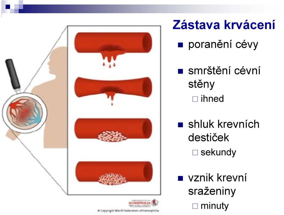 ihned shluk krevních destiček