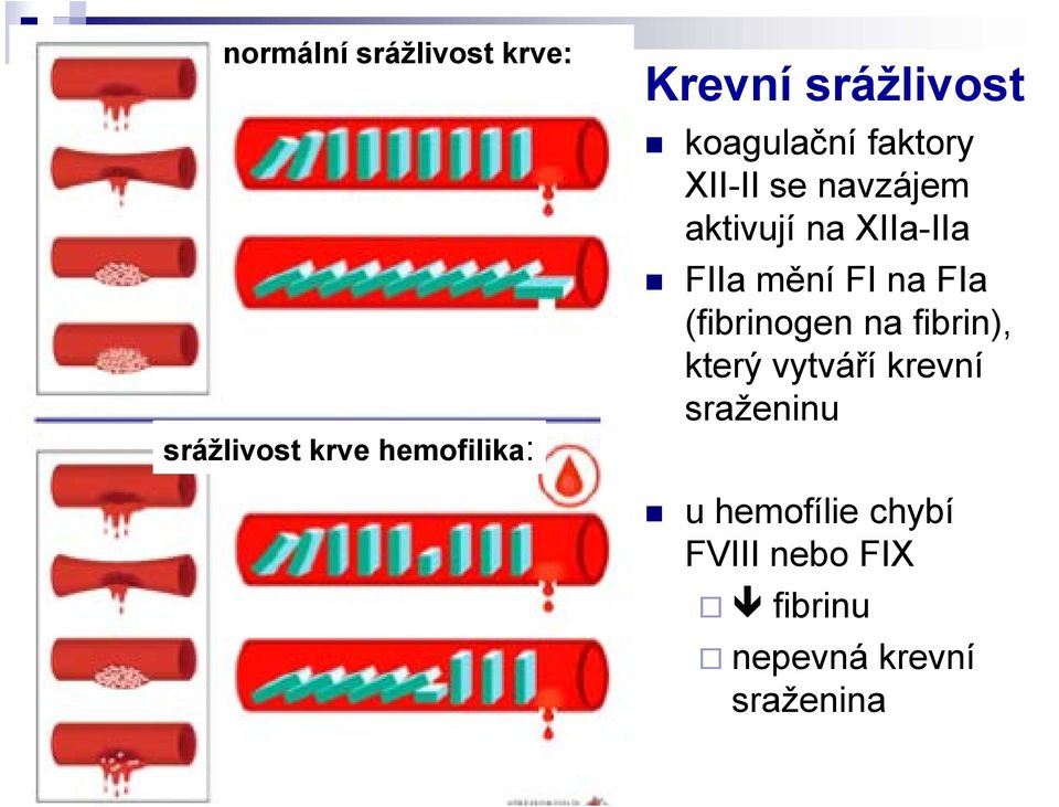 XIIa-IIa FIIa mění FI na FIa (fibrinogen na fibrin), který vytváří
