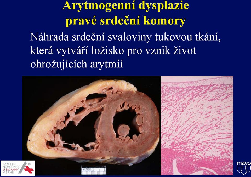 tukovou tkání, která vytváří