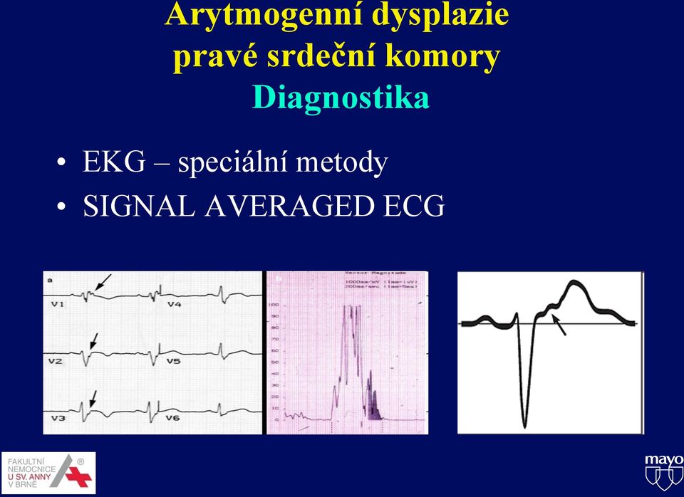 Diagnostika EKG