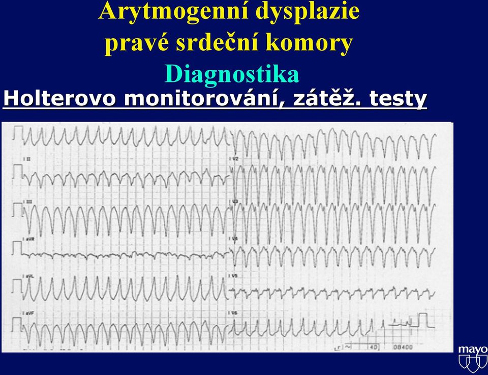 Diagnostika Holterovo