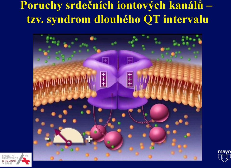 tzv. syndrom