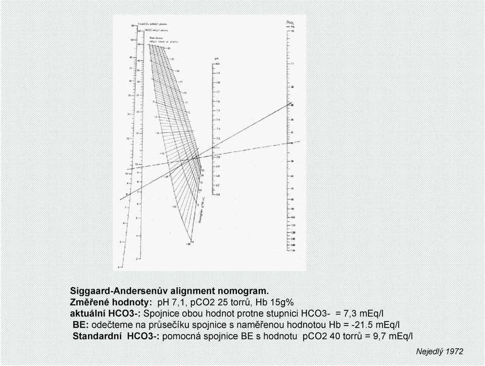 hodnot protne stupnici HCO3- = 7,3 meq/l BE: odečteme na průsečíku spojnice s