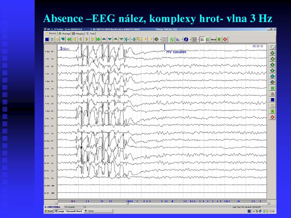 komplexy