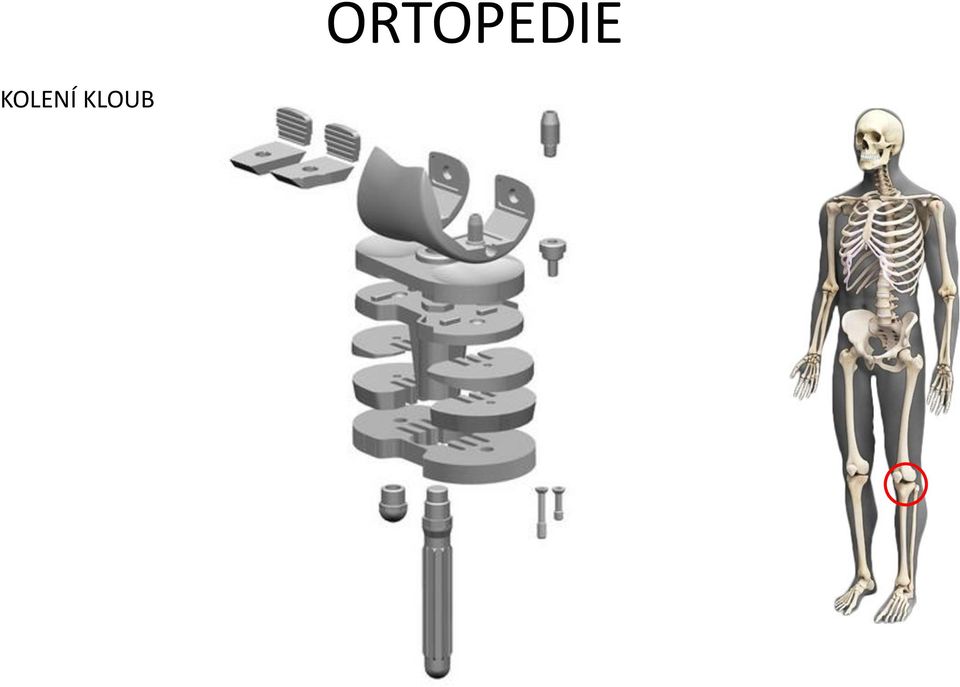 ORTOPEDIE