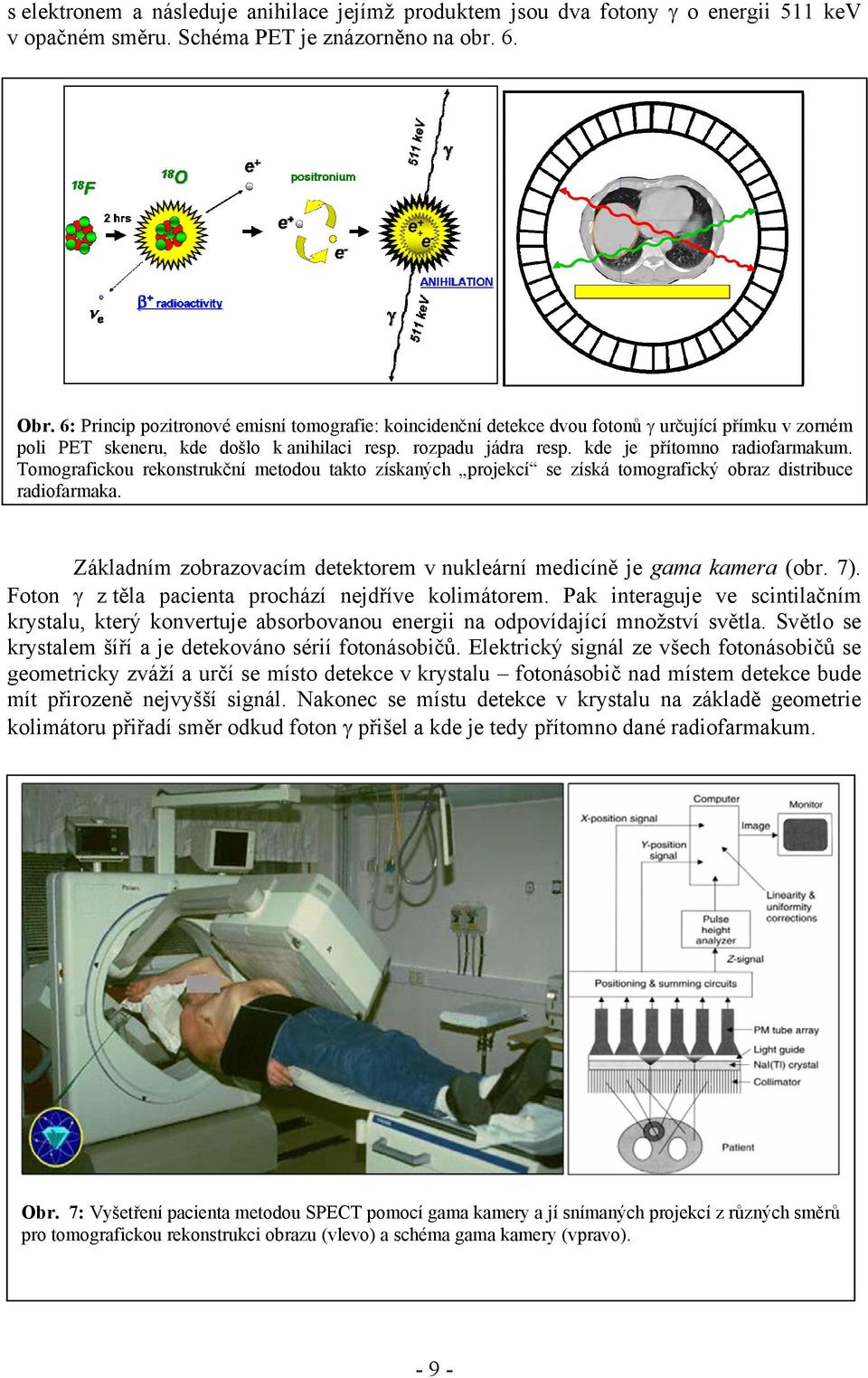 Tomografickou rekonstrukční metodou takto získaných projekcí se získá tomografický obraz distribuce radiofarmaka. Základním zobrazovacím detektorem v nukleární medicíně je gama kamera (obr. 7).