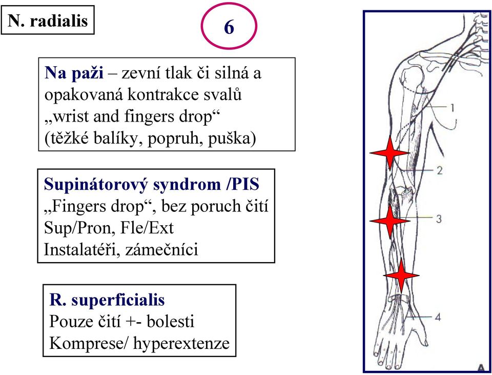 syndrom /PIS Fingers drop, bez poruch čití Sup/Pron, Fle/Ext