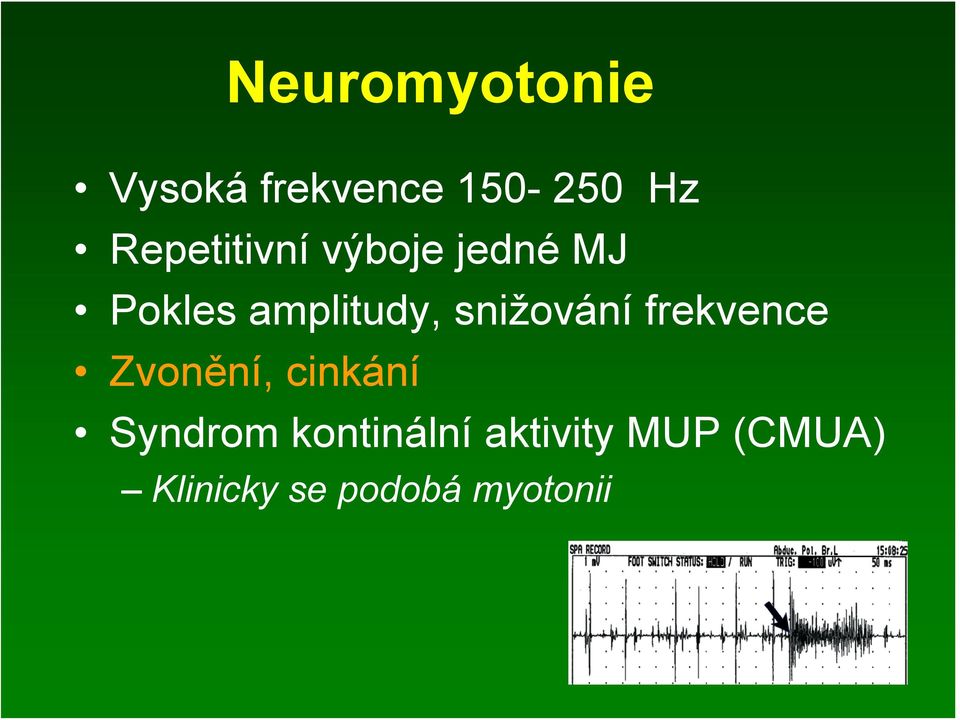 snižování frekvence Zvonění, cinkání Syndrom