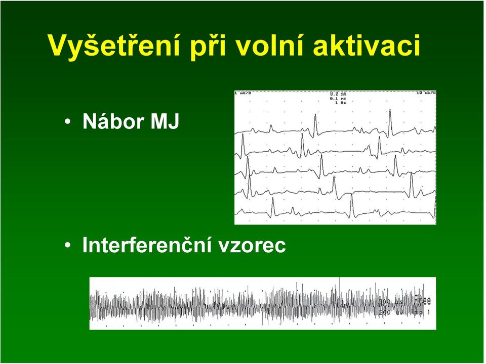 Nábor MJ