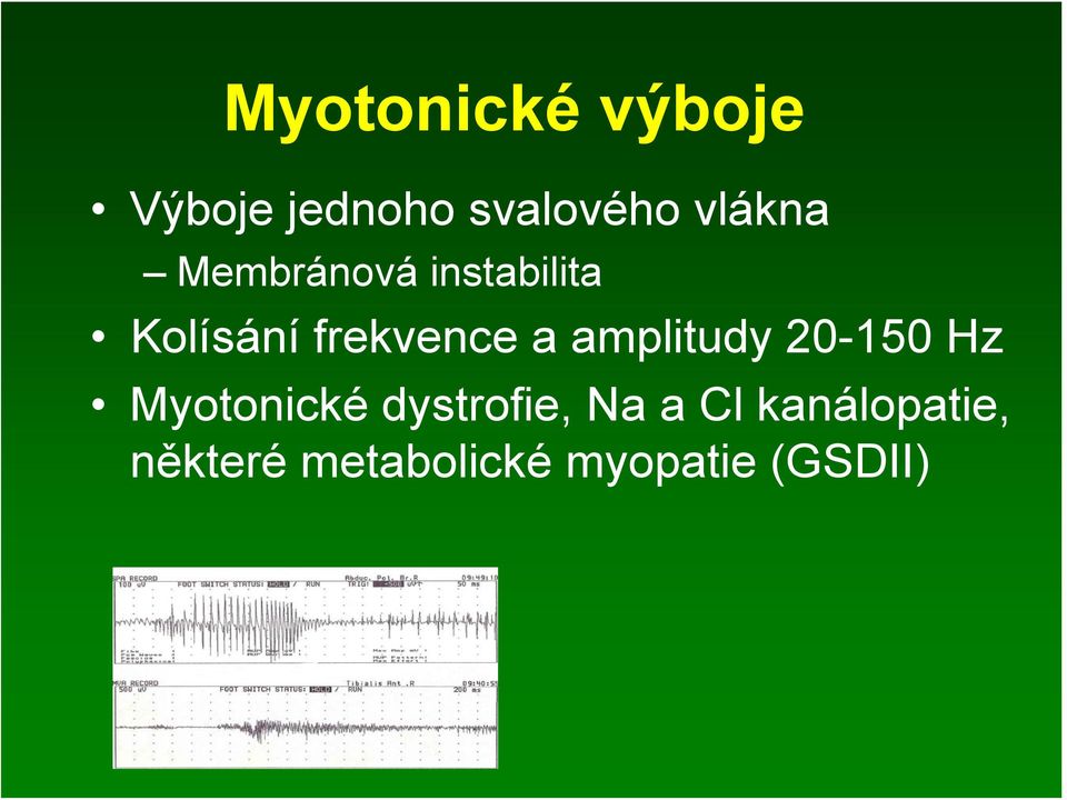 a amplitudy 20-150 Hz Myotonické dystrofie, Na a