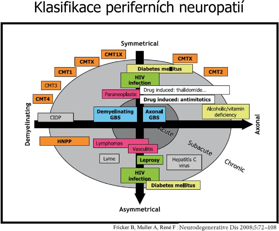 neuropatií