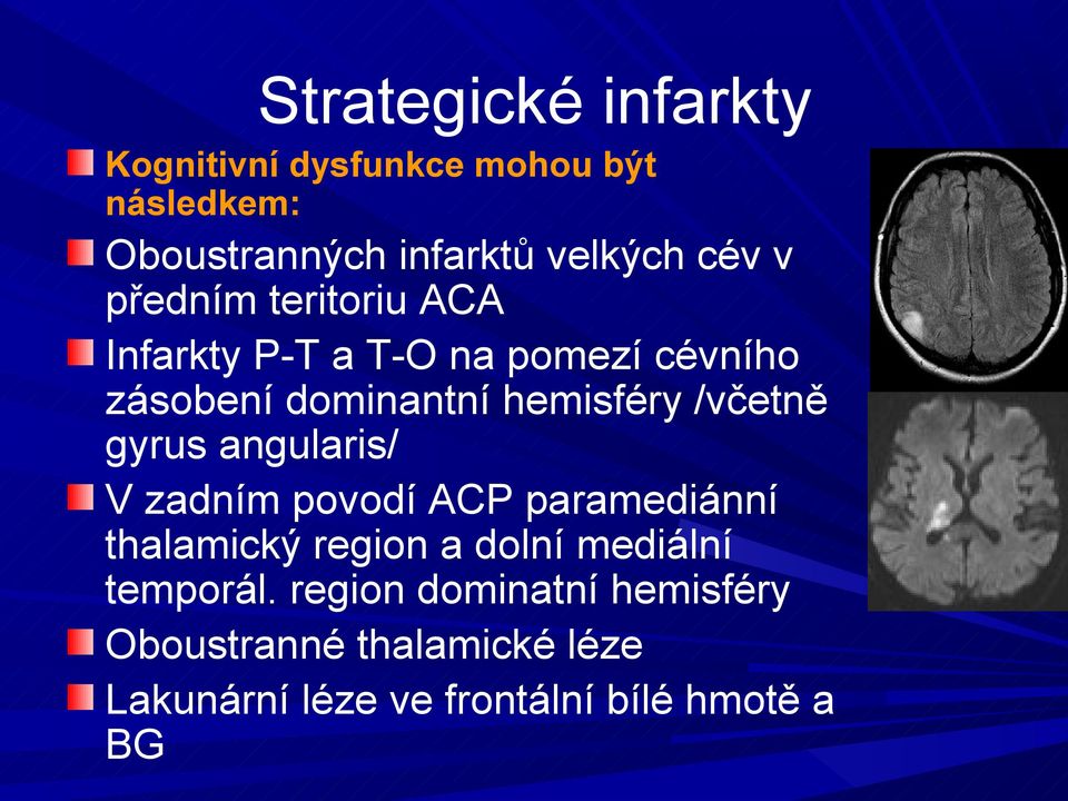 /včetně gyrus angularis/ V zadním povodí ACP paramediánní thalamický region a dolní mediální