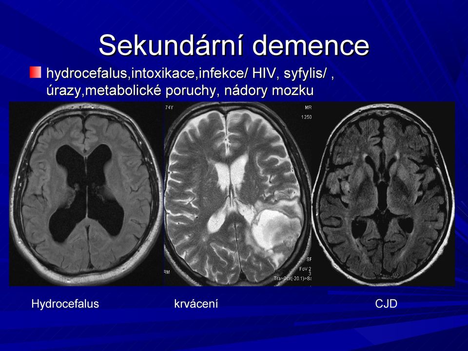 HIV, syfylis/, úrazy,metabolické