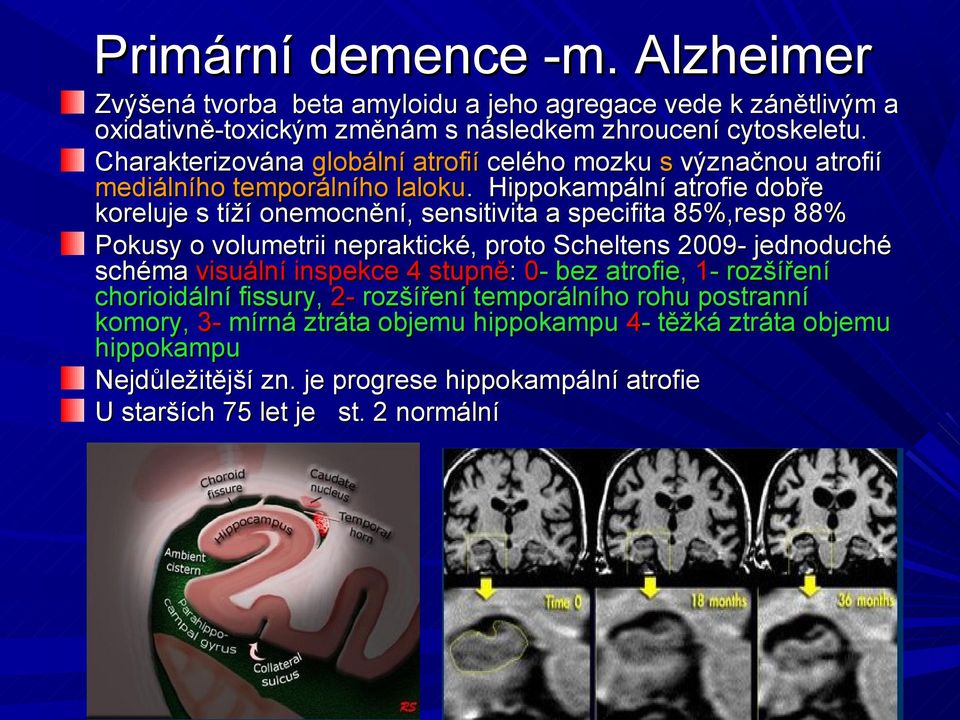 Hippokampální atrofie dobře koreluje s tíží onemocnění, sensitivita a specifita 85%,resp 88% Pokusy o volumetrii nepraktické, proto Scheltens 2009- jednoduché schéma visuální