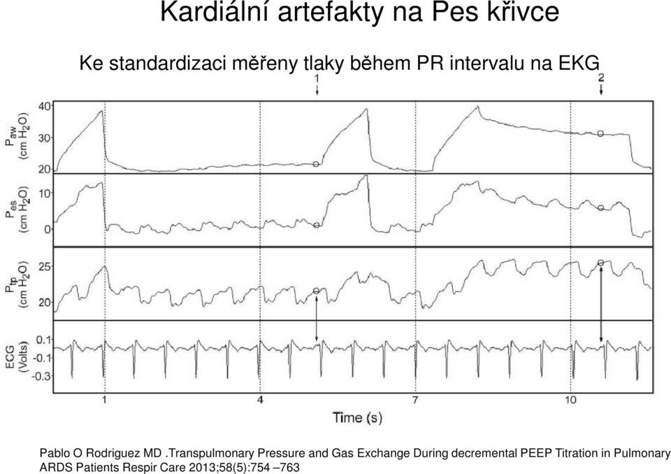 Transpulmonary Pressure and Gas Exchange During decremental