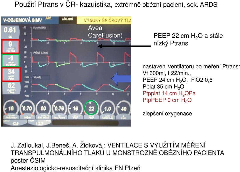 22/min., PEEP 24 cm H 2 O, FiO2 0,6 Pplat 35 cm H 2 O Ptpplat 14 cm H 2 OPa PtpPEEP 0 cm H 2 O zlepšení oxygenace J.