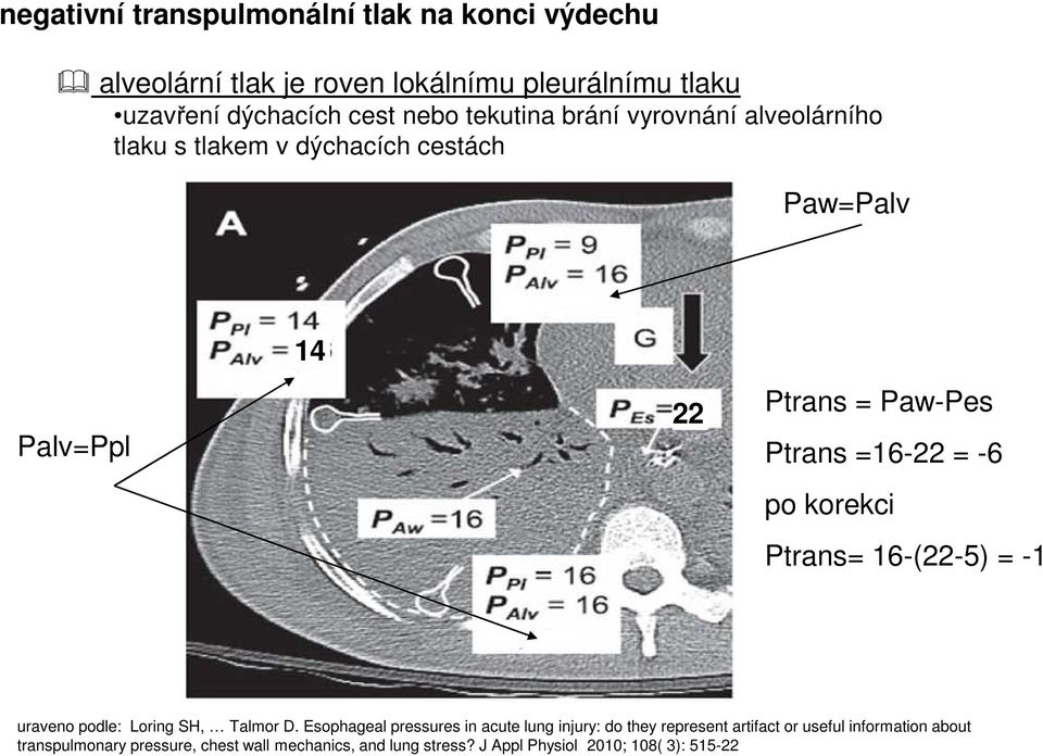 po korekci Ptrans= 16-(22-5) = -1 uraveno podle: Loring SH, Talmor D.