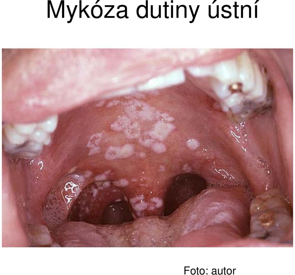 ústní