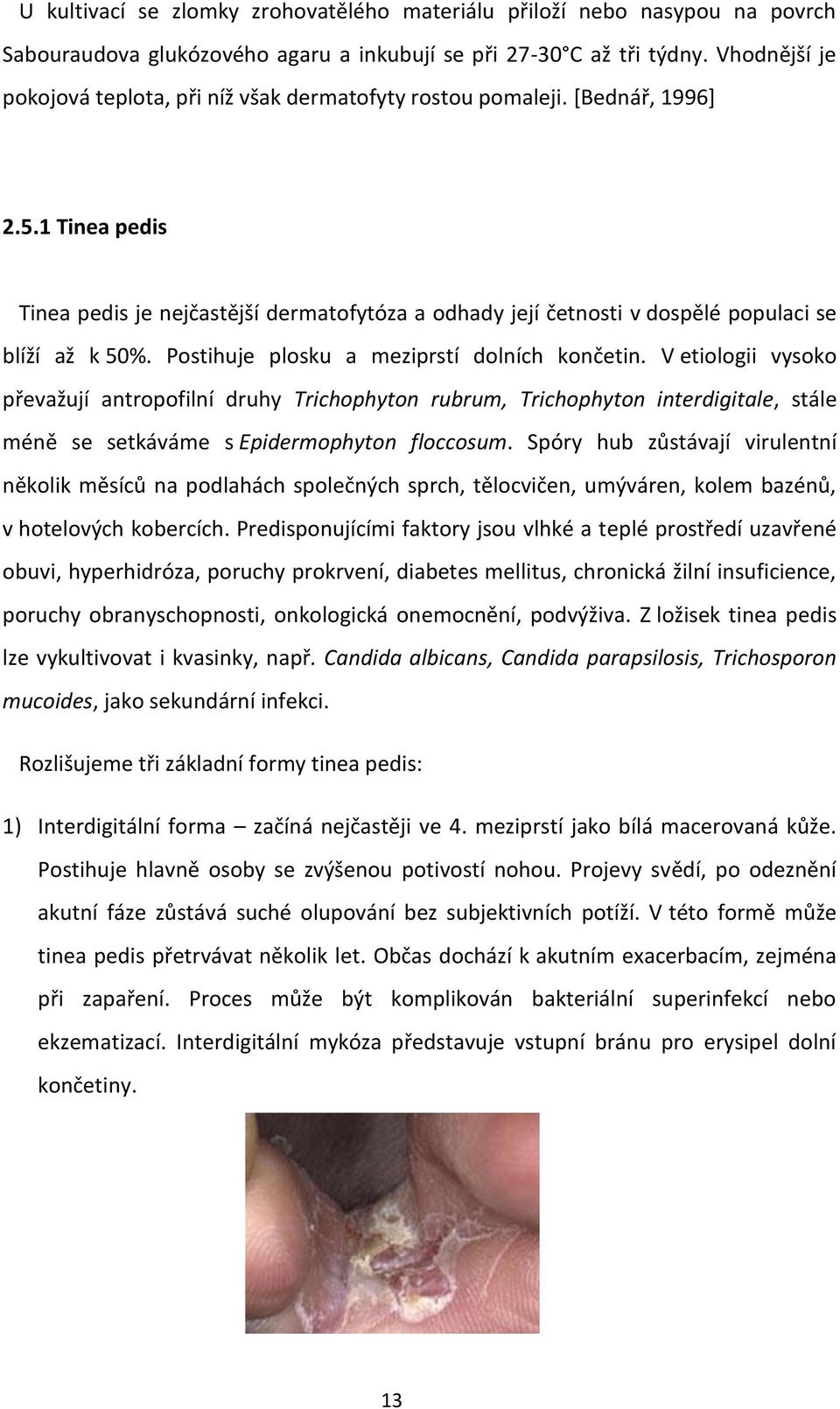 1 Tinea pedis Tinea pedis je nejčastější dermatofytóza a odhady její četnosti v dospělé populaci se blíží až k 50%. Postihuje plosku a meziprstí dolních končetin.