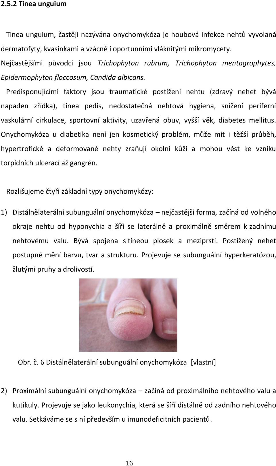 Predisponujícími faktory jsou traumatické postižení nehtu (zdravý nehet bývá napaden zřídka), tinea pedis, nedostatečná nehtová hygiena, snížení periferní vaskulární cirkulace, sportovní aktivity,
