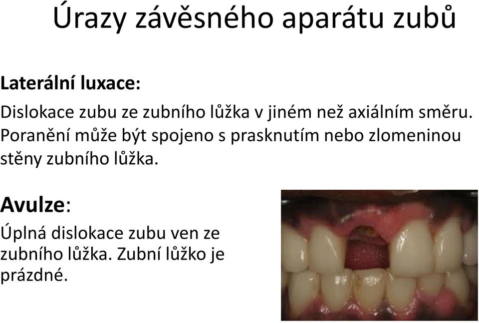 Poranění může být spojeno s prasknutím nebo zlomeninou stěny