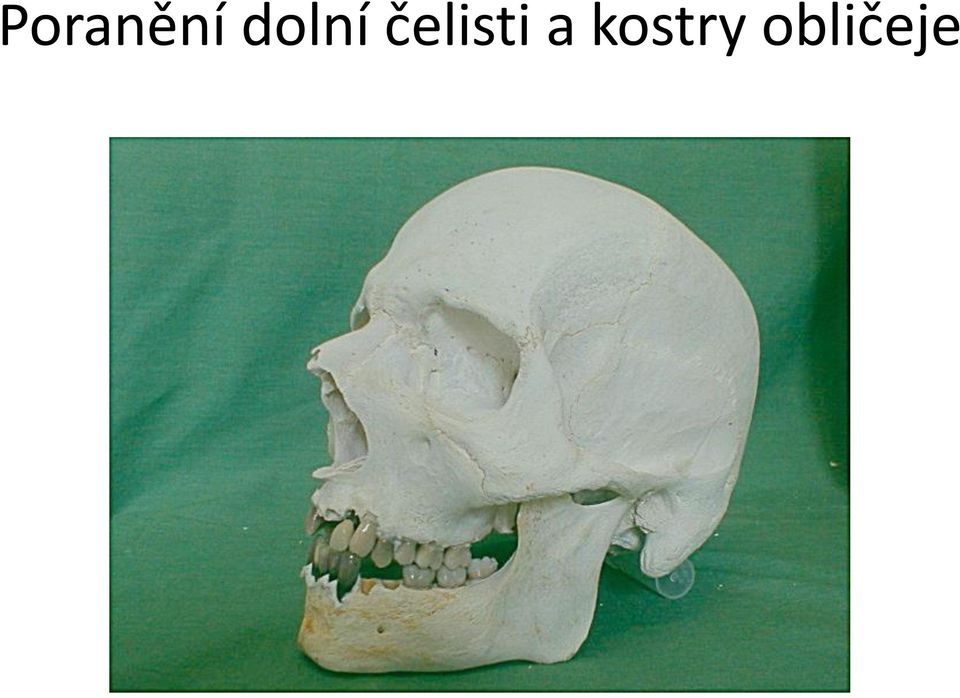 čelisti a