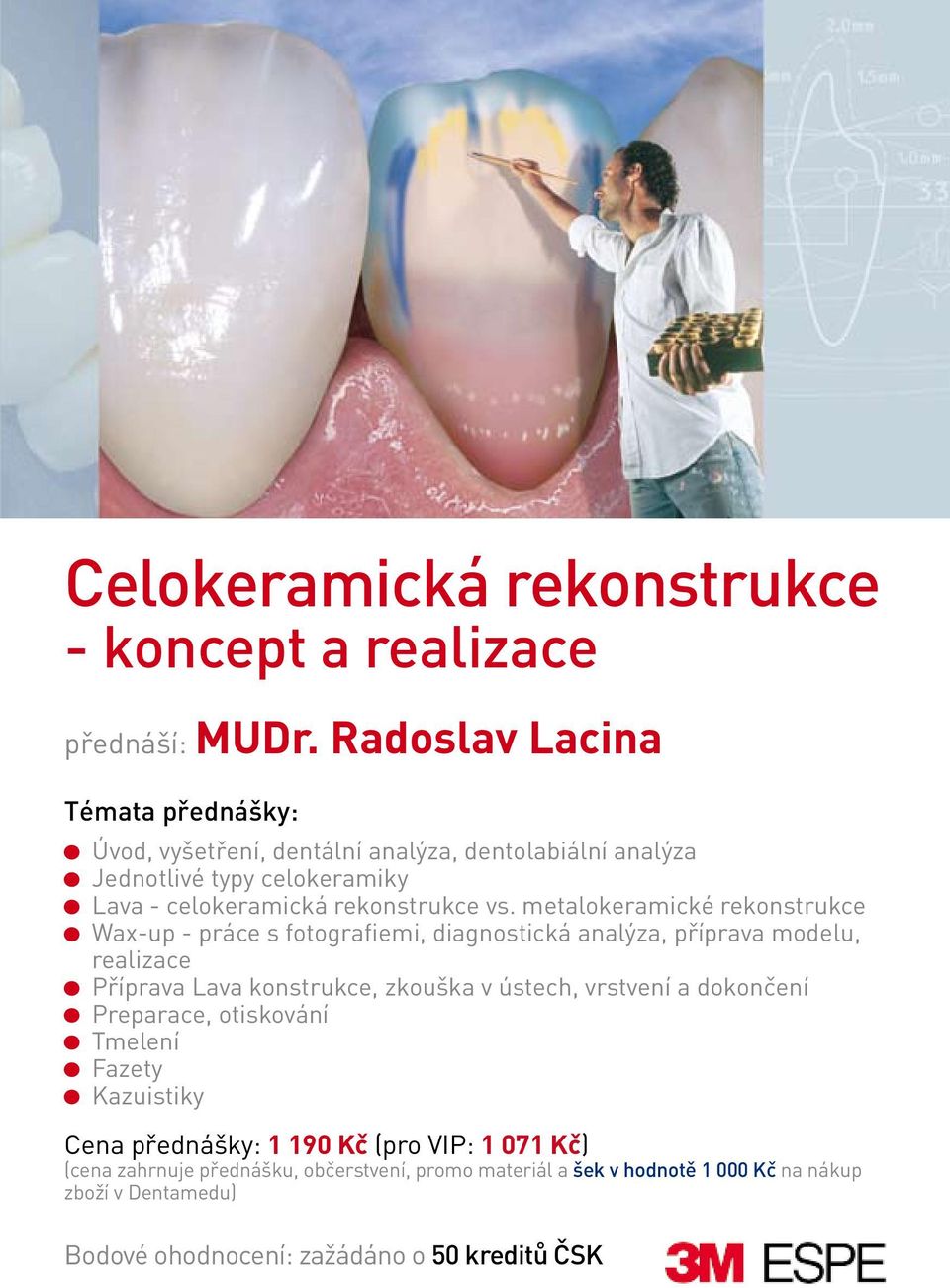 modelu, realizace Příprava Lava konstrukce, zkouška v ústech, vrstvení a dokončení Preparace, otiskování Tmelení Fazety Kazuistiky Cena přednášky: 1 190 Kč