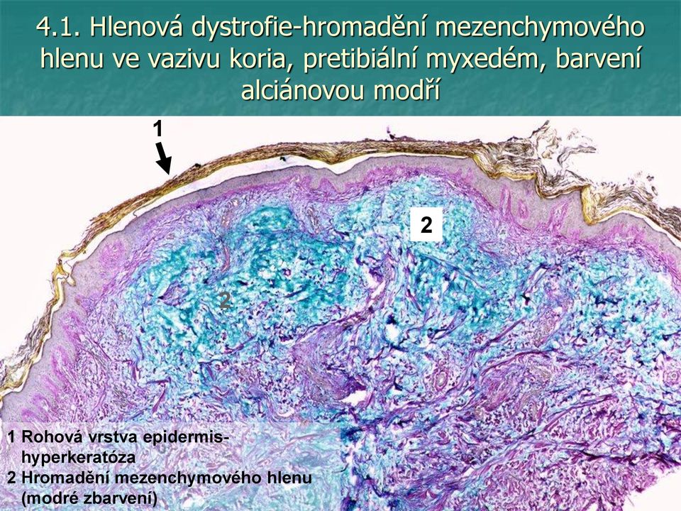 barvení alciánovou modří Rohová vrstva