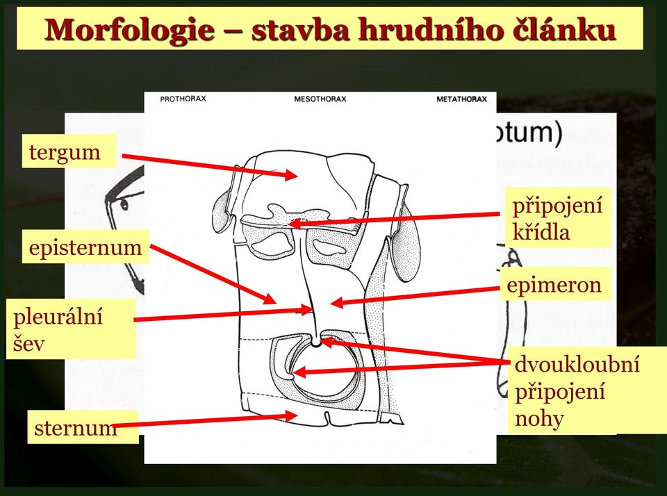 pleurální šev sternum připojení