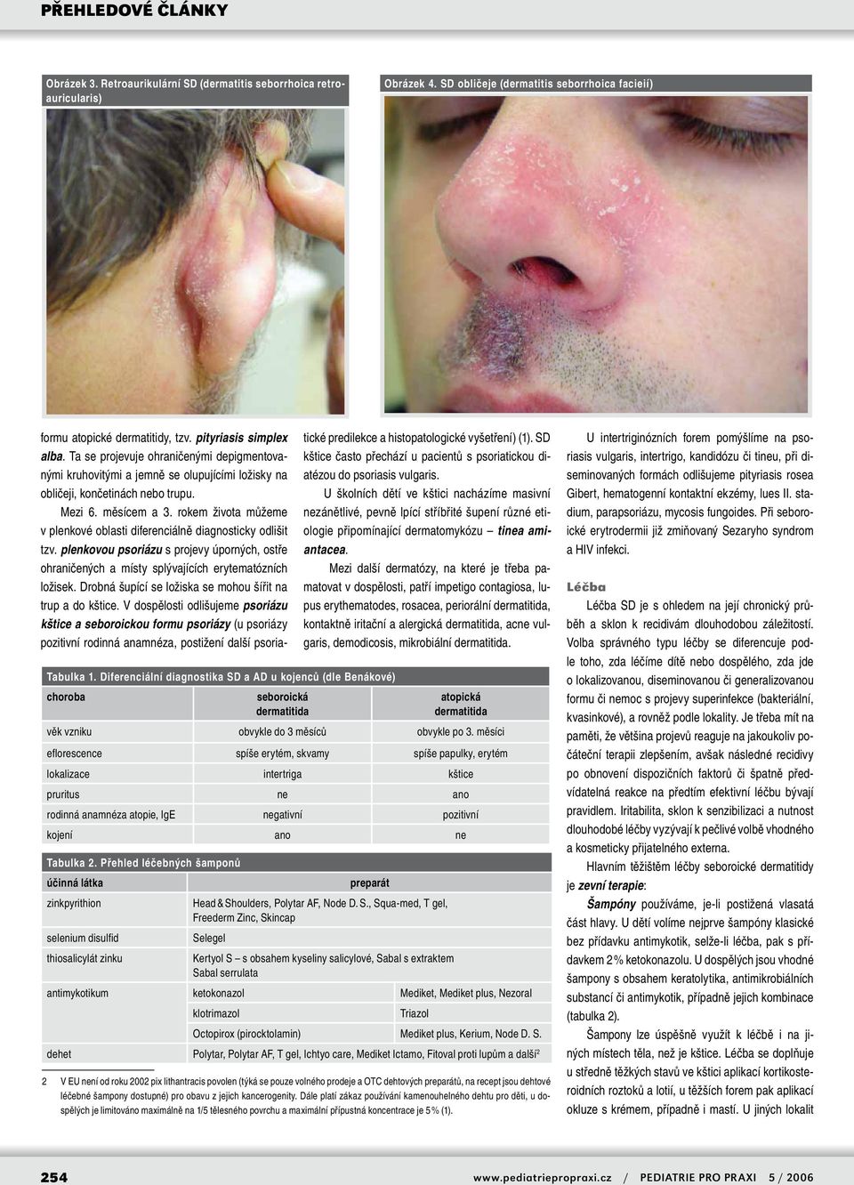 rokem života můžeme v plenkové oblasti diferenciálně diagnosticky odlišit tzv. plenkovou psoriázu s projevy úporných, ostře ohraničených a místy splývajících erytematózních ložisek.