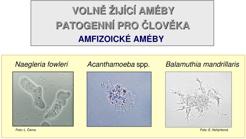 fowleri Acanthamoeba spp.