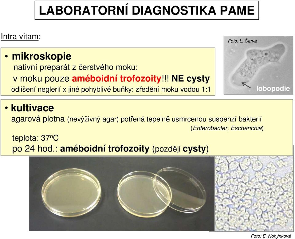 Červa lobopodie kultivace agarová plotna (nevýživný agar) potřená tepelně usmrcenou suspenzí bakterií