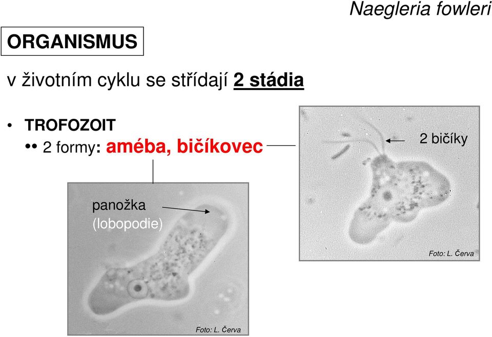 formy: améba, bičíkovec 2 bičíky panožka