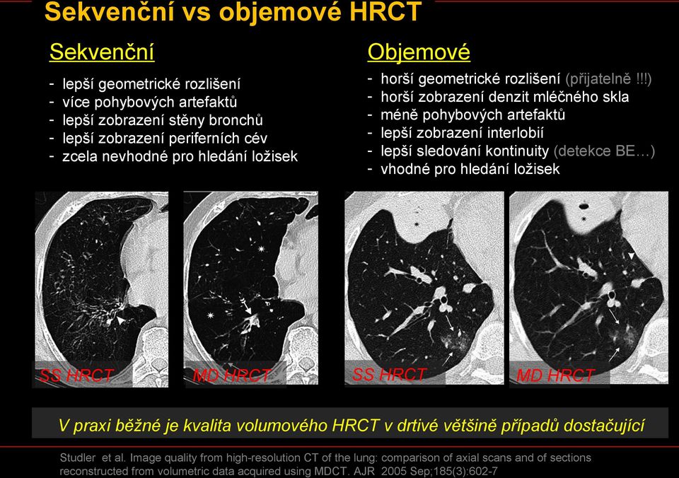 !!) horší zobrazení denzit mléčného skla méně pohybových artefaktů lepší zobrazení interlobií lepší sledování kontinuity (detekce BE ) vhodné pro hledání ložisek SS HRCT MD