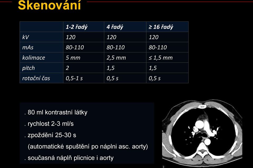 0,5 s 0,5 s. 80 ml kontrastní látky. rychlost 2-3 ml/s.