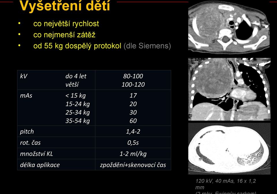 15-24 kg 25-34 kg 35-54 kg 17 20 30 60 pitch 1,4-2 rot.