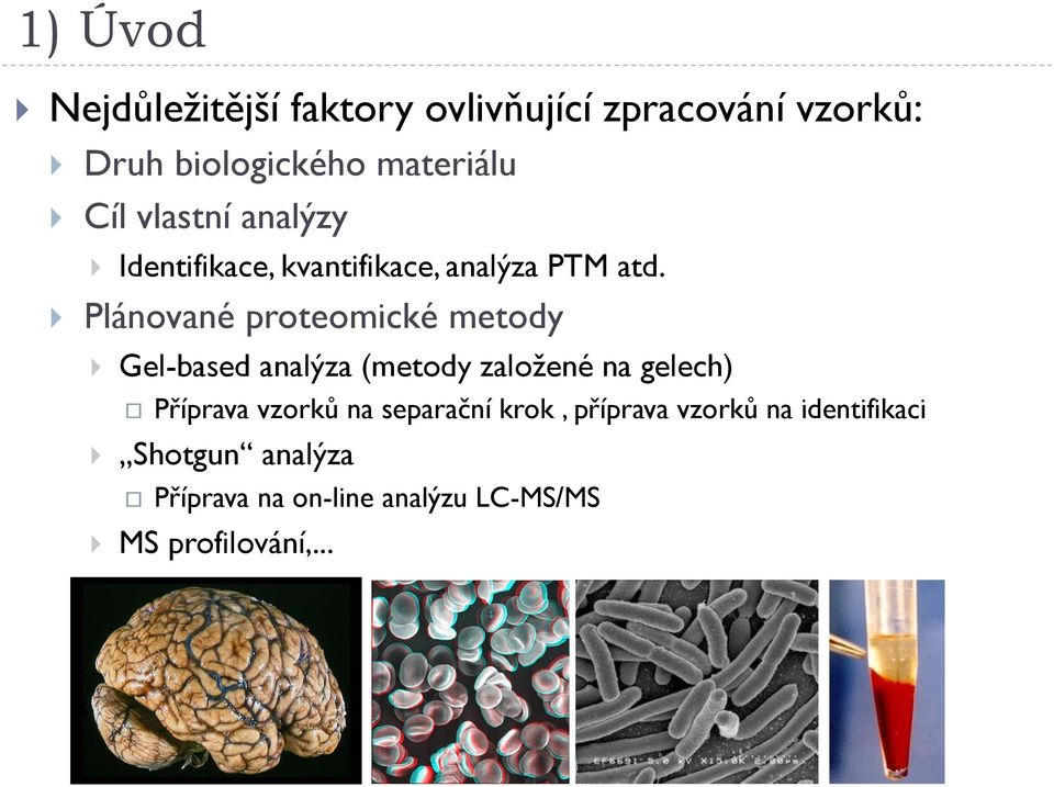 Plánované proteomické metody Gel-based analýza (metody založené na gelech) Příprava vzorků