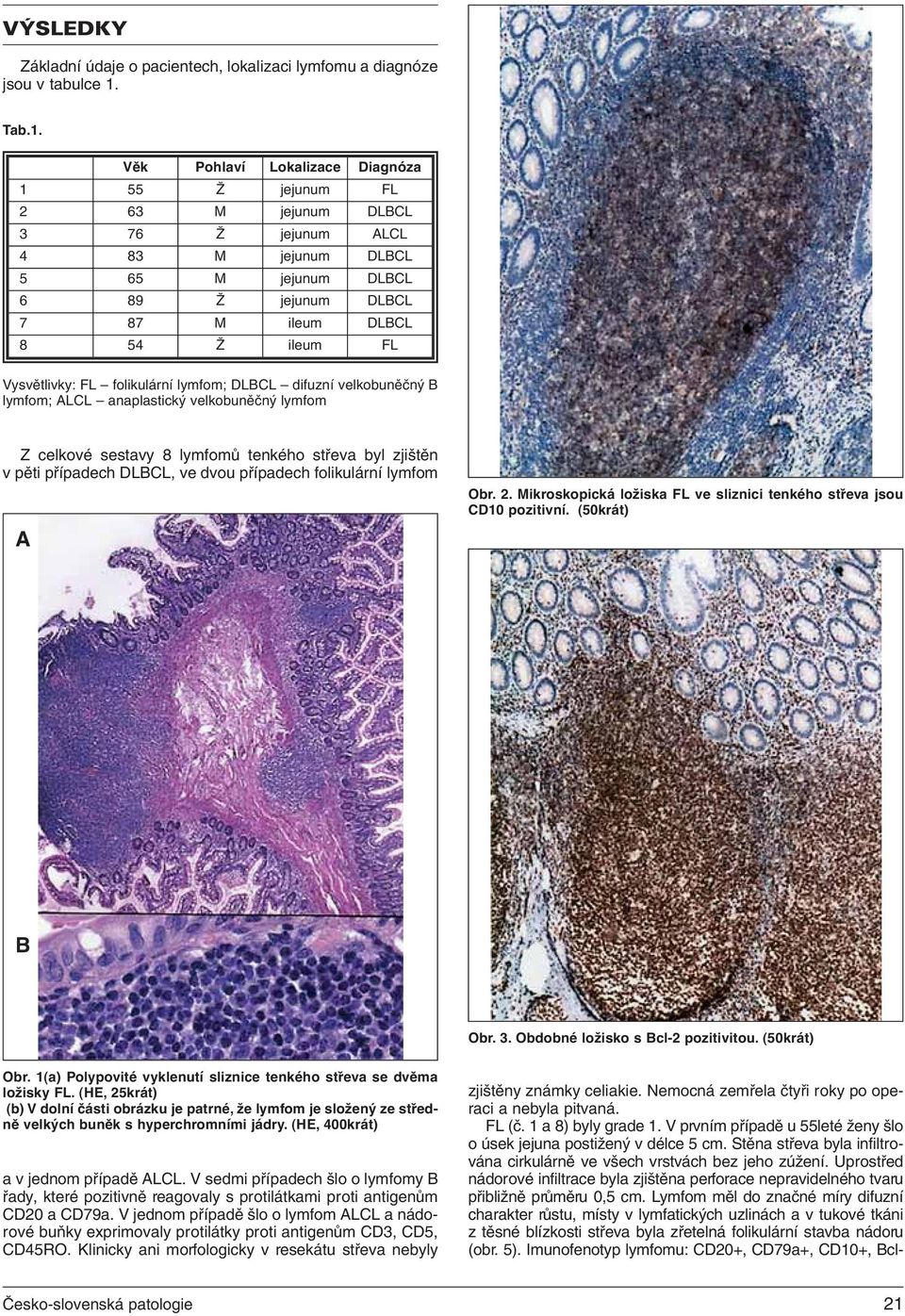 Věk Pohlaví Lokalizace Diagnóza 1 55 Ž jejunum FL 2 63 M jejunum DLCL 3 76 Ž jejunum ALCL 4 83 M jejunum DLCL 5 65 M jejunum DLCL 6 89 Ž jejunum DLCL 7 87 M ileum DLCL 8 54 Ž ileum FL Vysvětlivky: FL