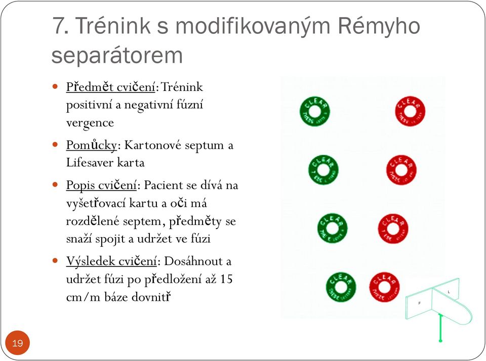 Pacient se dívá na vyšetřovací kartu a oči má rozdělené septem, předměty se snaží spojit