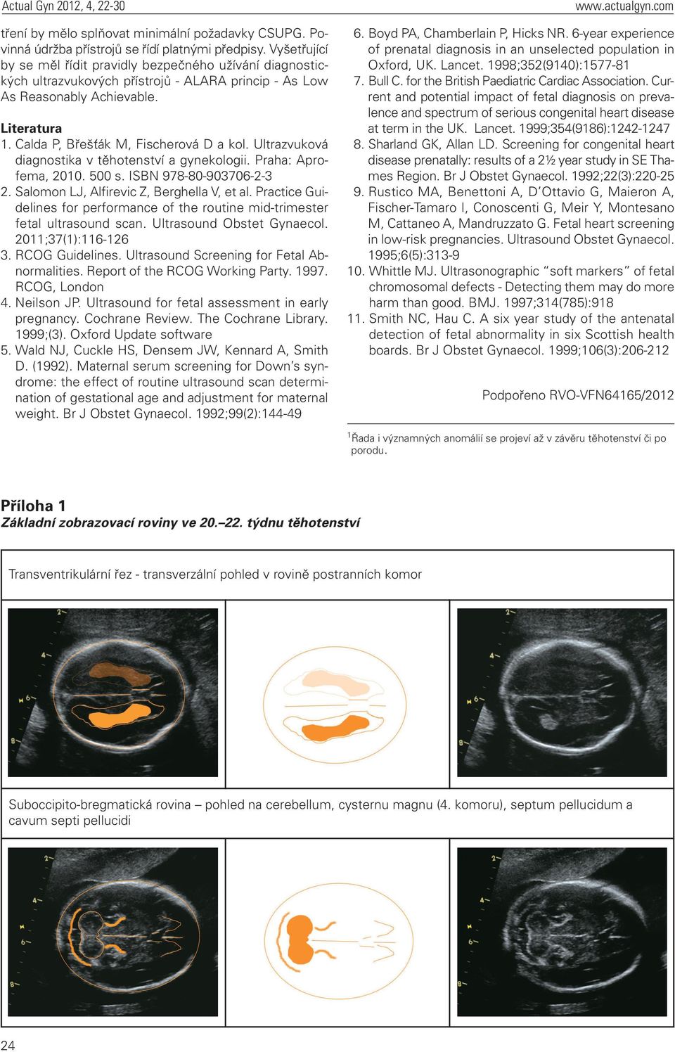 Ultrazvuková diagnostika v těhotenství a gynekologii. Praha: Aprofema, 2010. 500 s. ISBN 978-80-903706-2-3 2. Salomon LJ, Alfirevic Z, Berghella V, et al.