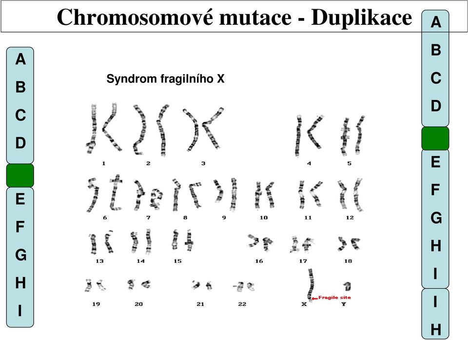 Duplikace Syndrom