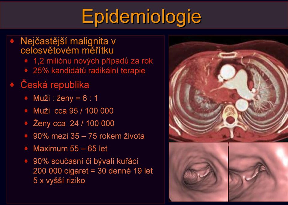 Muži cca 95 / 100 000 Ženy cca 24 / 100 000 90% mezi 35 75 rokem života Maximum 55