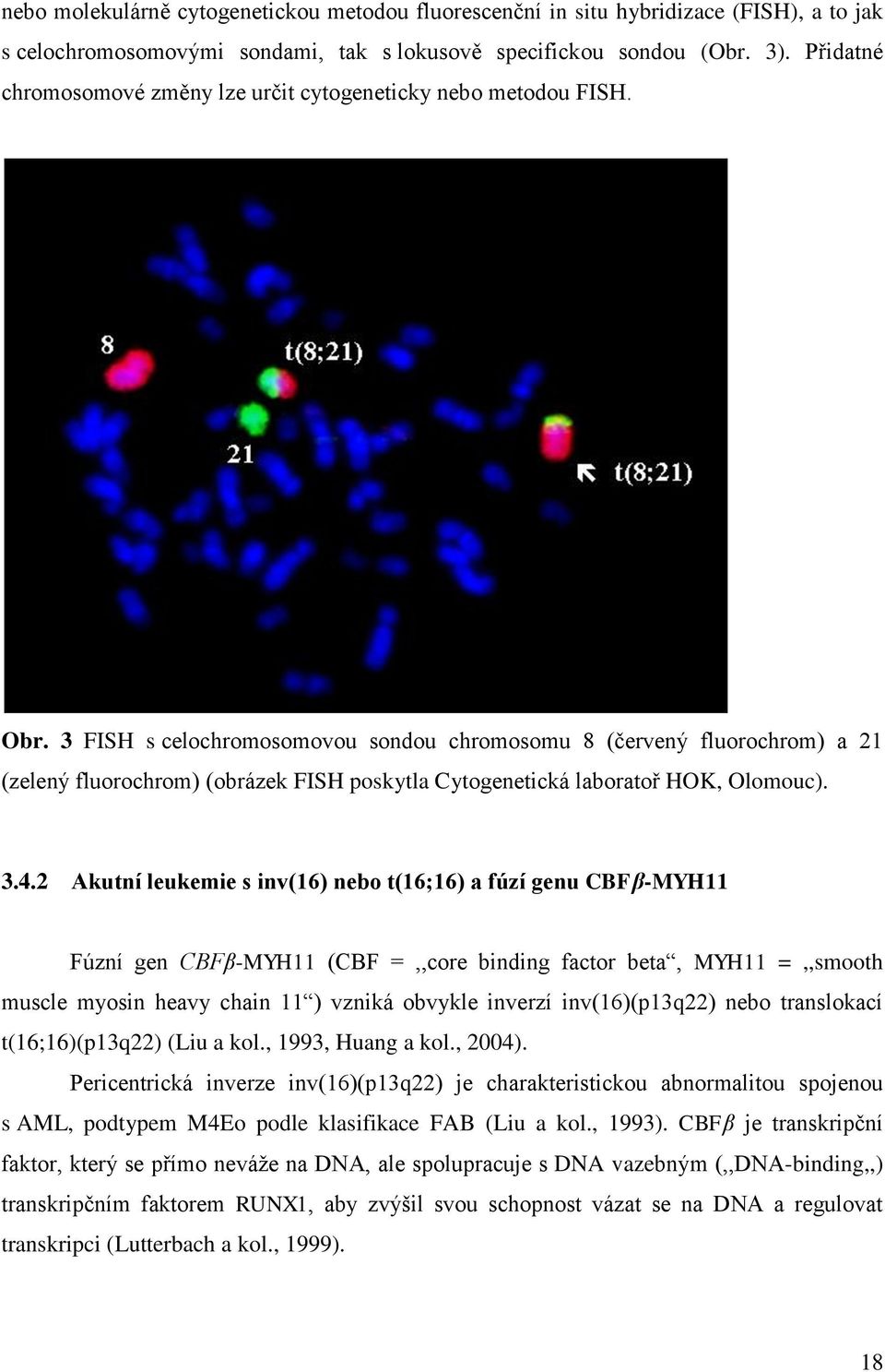 3 FISH s celochromosomovou sondou chromosomu 8 (červený fluorochrom) a 21 (zelený fluorochrom) (obrázek FISH poskytla Cytogenetická laboratoř HOK, Olomouc). 3.4.